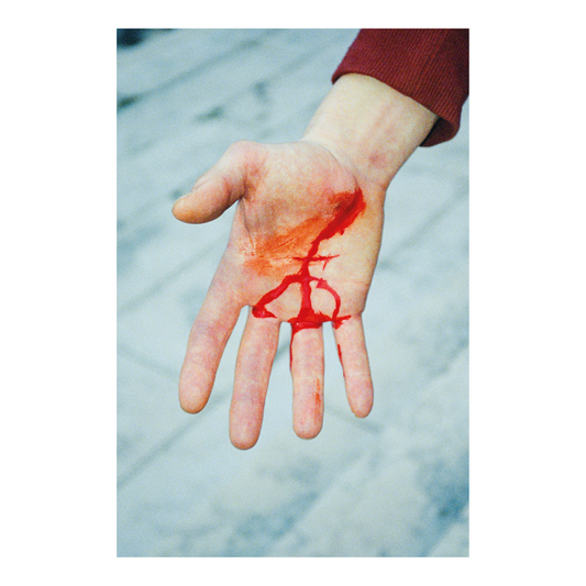 Yedihael Canat - Bleeding Hand